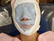 パックを塗った後、骨格を固定する為包帯巻く