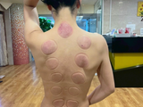 オプションのカッピング